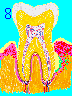 Late Gum Disease