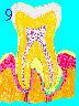 Very Late Gum Disease