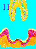 Tooth Falls Out